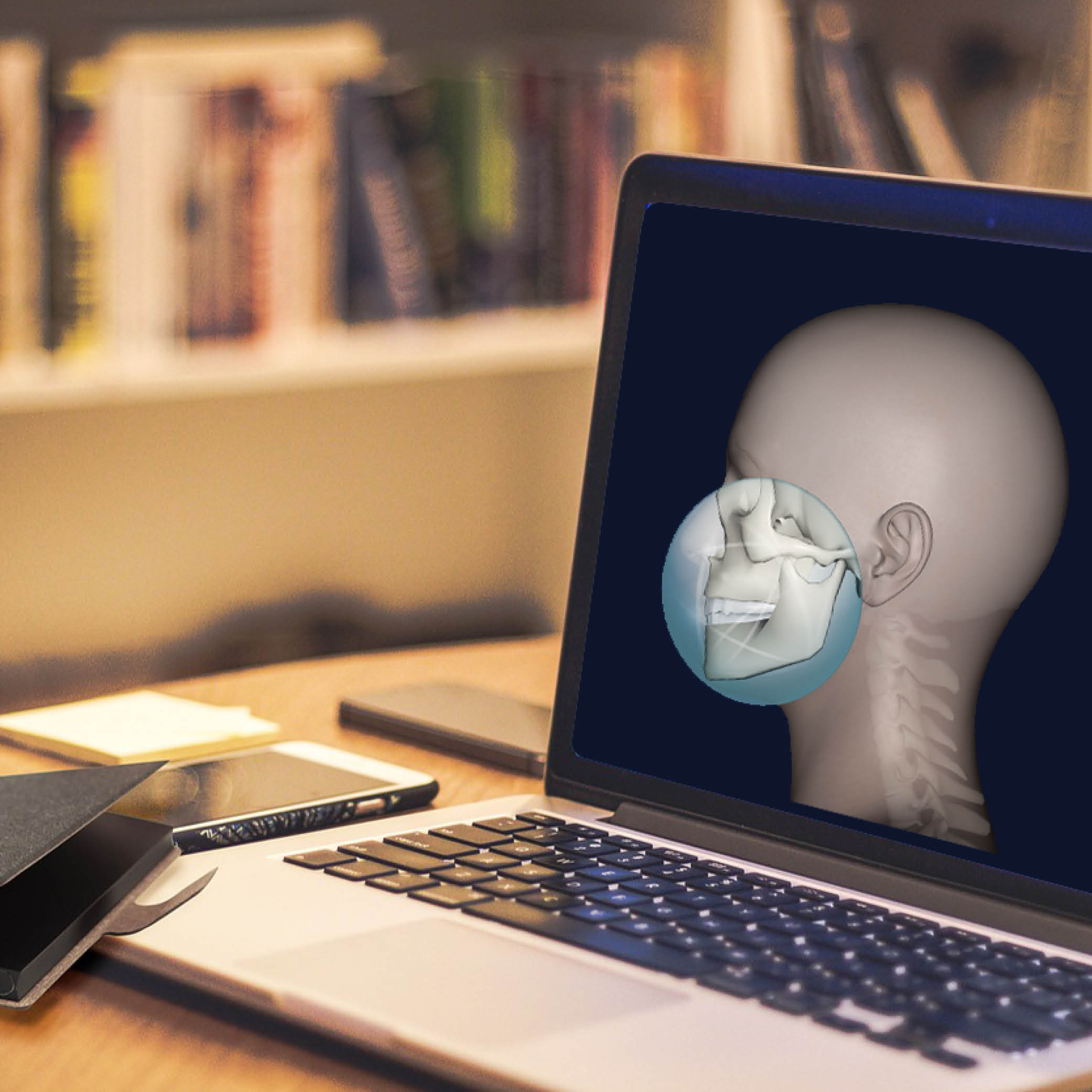 Nahaufnahme eines Laptops auf einem Schreibtischs mit frisch ausgepacktem Smartphone, der Monitor zeigt eine Darstellung eines menschlichen Kopfes von der Seite, durch die virtuelle Haut sind die Nackenwirbel zu sehen, ein Kreis um die Kieferpartie zeigt deutlich die Knochen und Zähne.